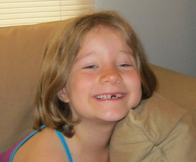 PhoenixLostToothCropped